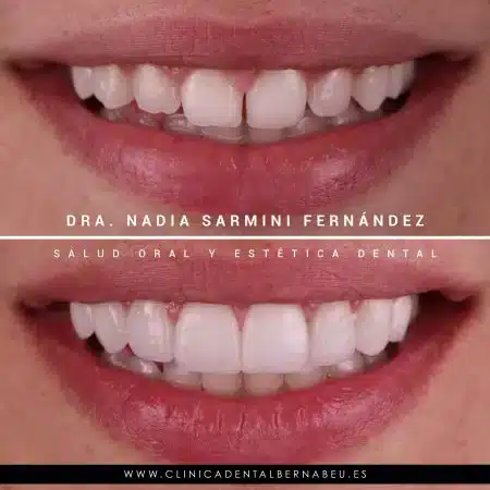 ALTHEA SANTOS DE LA CALLE