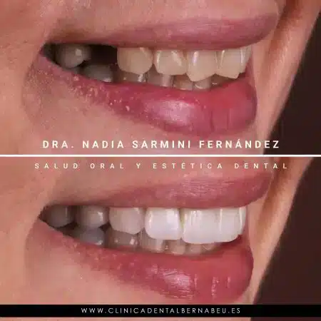 CHARO-NAVARRO2-1-450x450