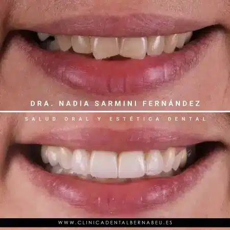 CHARO-NAVARRO3-1-450x450