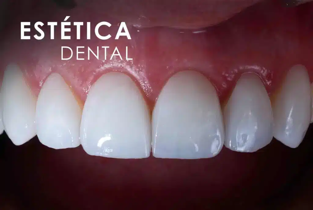 ESTETICA-DENTAL-scaled-1-1024x687