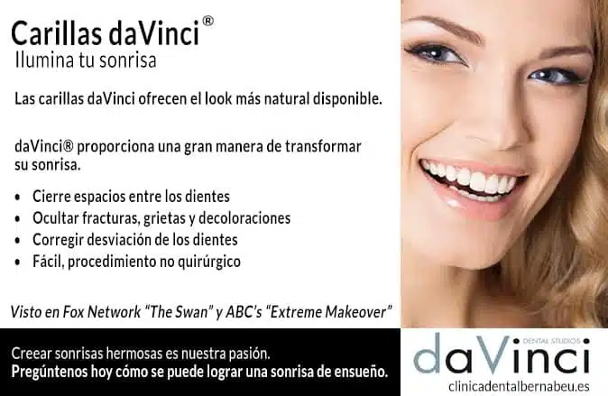 carillas-dentales-davinci