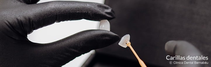 diferencia-carillas-corona-funda