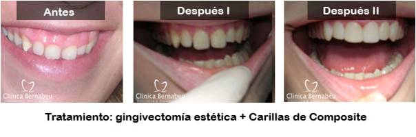 periodoncia3