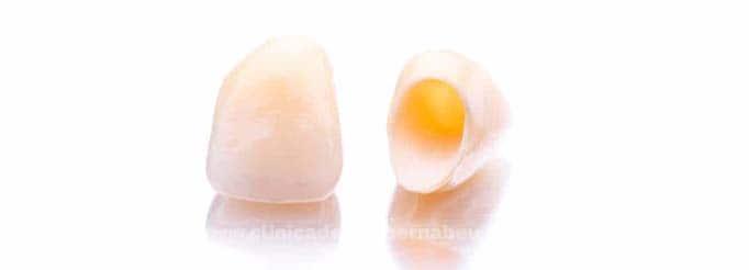 corona-de-zirconio