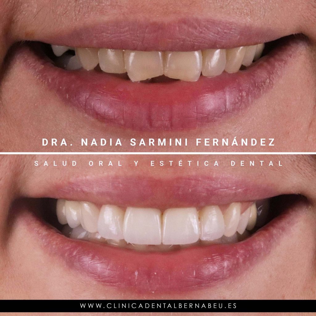 ANTES Y DESPUÉS