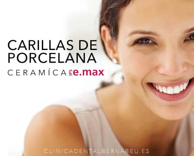 carillas e max
