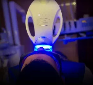 Paciente con tratamiento zoom de philips