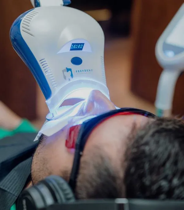 Blanqueamiento en clínica dental con luz fría en Madrid