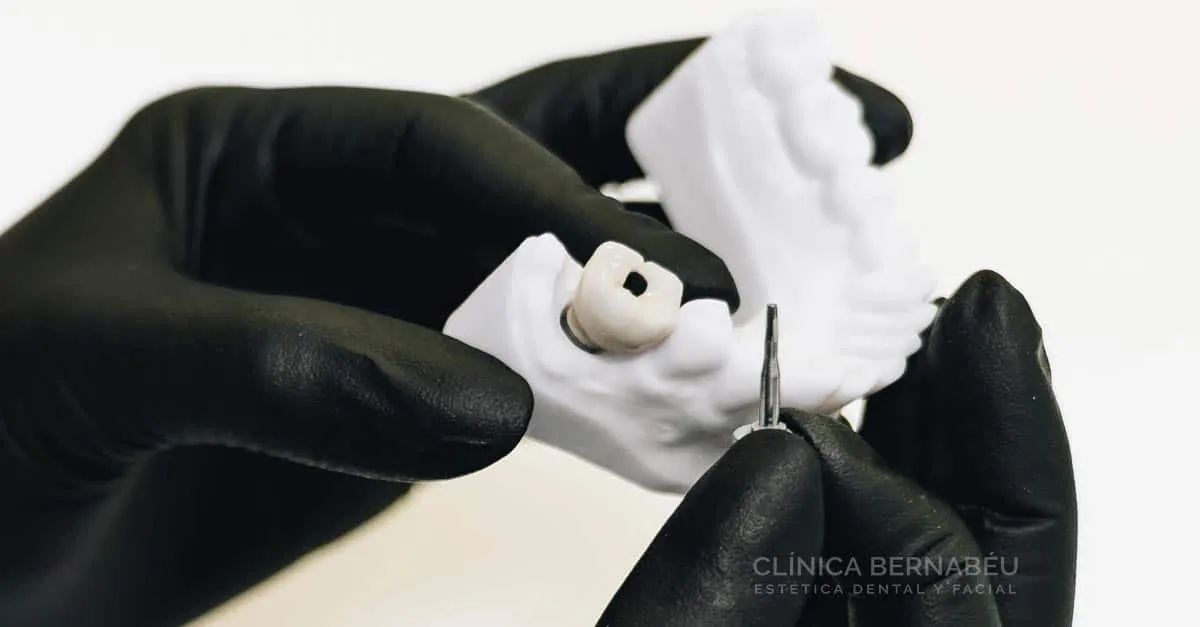 Implantes sin hueso
