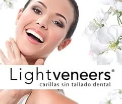 Carillas LightVeneers en Clínica Dental Bernabéu, Madrid — tratamiento sin tallado